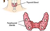 parathyroid-thumb