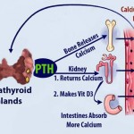 calcium-imbalances-caused-by-parathyroid-disorders