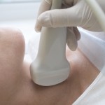 thyroid-ultrasound